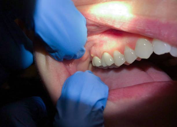 Best Emergency Gum Pain Relief  in Hasley Nyon, CA