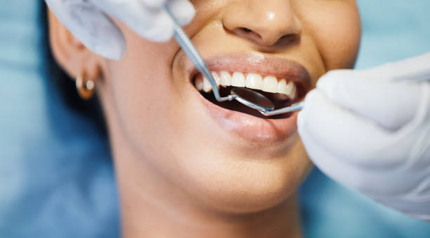 Best Chipped Tooth Repair Near Me  in Hasley Nyon, CA