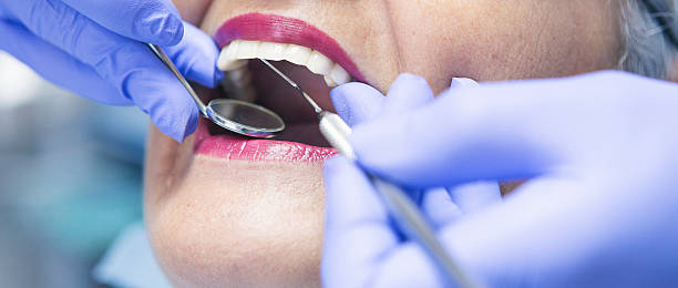 Best Teeth Whitening  in Hasley Nyon, CA